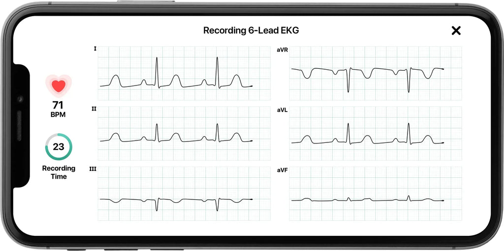 KardiaMobile 6L Personal EKG Monitor with Most Smartphones
