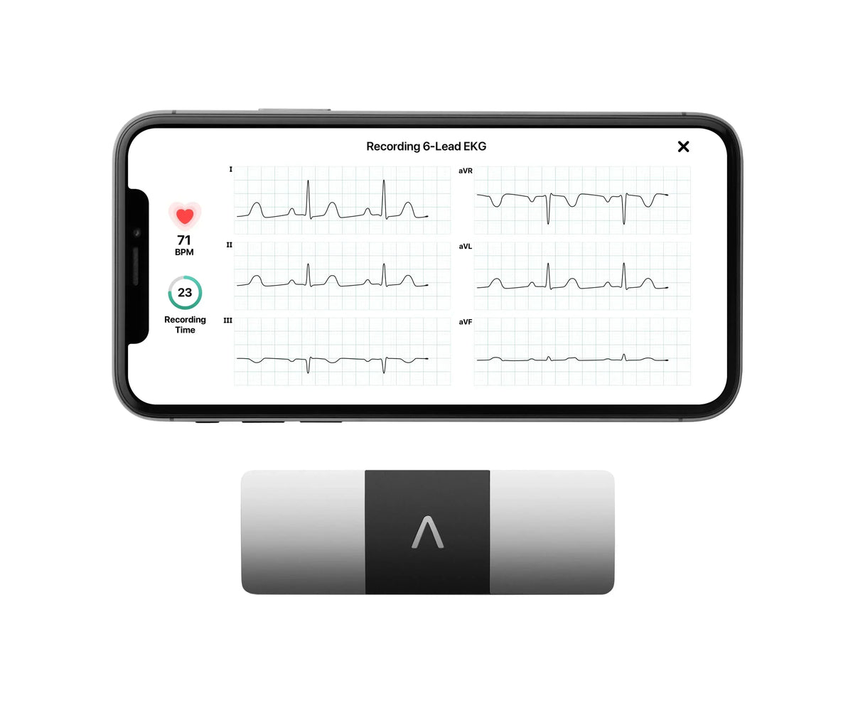 KardiaMobile 6L Personal EKG Monitor with Most Smartphones